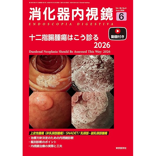 消化器内視鏡38巻3号2026年3月号 Back to Basics大腸腫瘍に対する内視